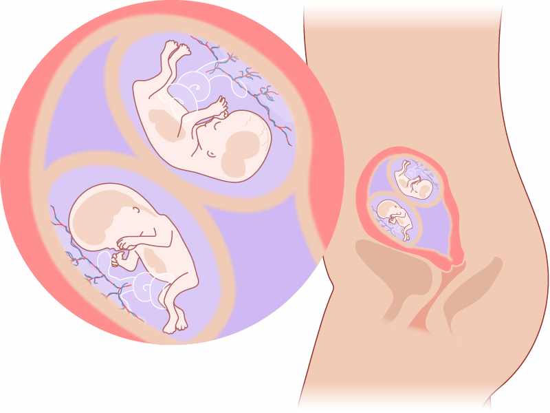 Развитие двойни по неделям беременности: описание