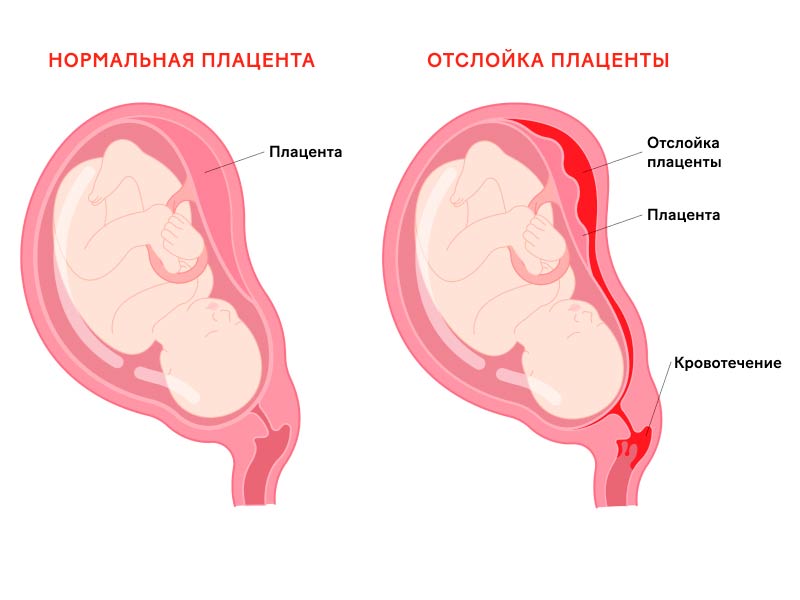 Каковы причины слабой полоски на тесте на беременность?