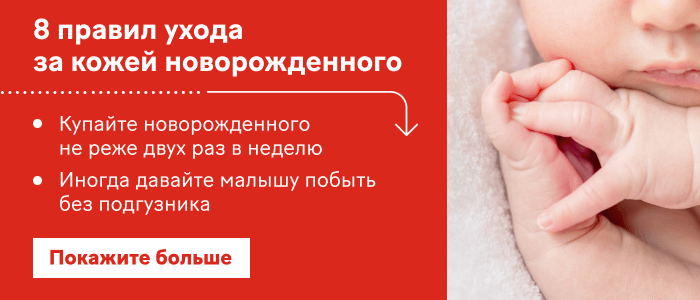 Третий гайд про новорожденных, раздел «Как бороться с проблемами кожи» 500х500-top