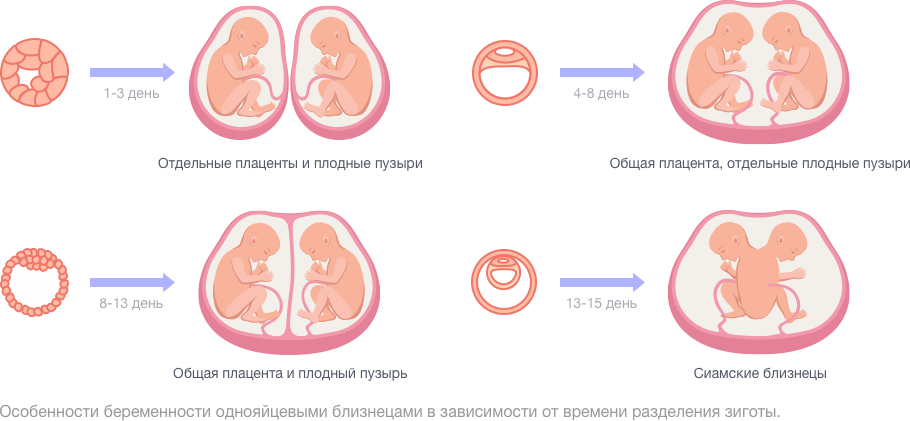 Роды двойни