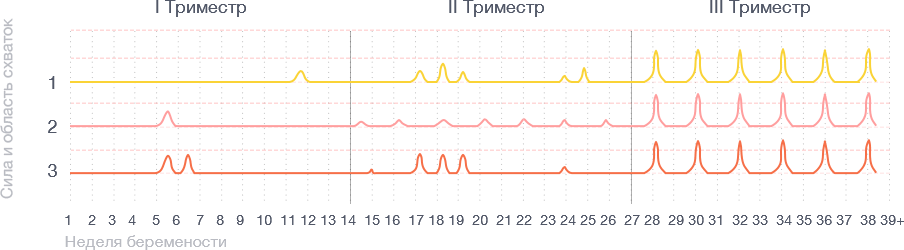 Усиление боли и распространение вниз по животу