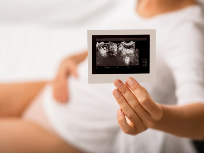 Что делать, если на ранних сроках беременности появилась киста яичника?