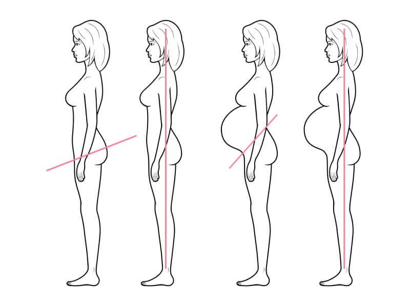 Смещение центра тяжести при беременности