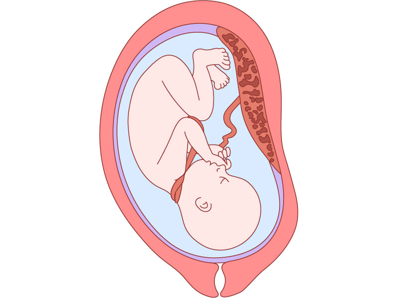 Классификация обвития пуповиной при беременности