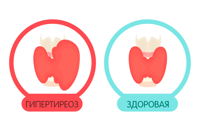 Заболевания щитовидной железы и беременность