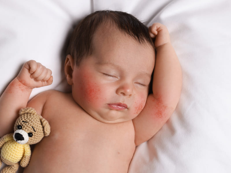 Чем опасен ротавирус для малыша?